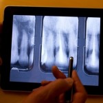 iPad radiografie